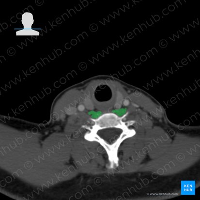 Longus colli muscle (Musculus longus colli); Image: 