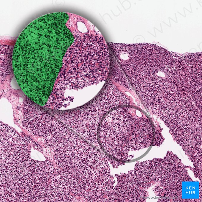 Parathyrocytus endocrinus lucidus (Helle Hauptzellen); Bild: 