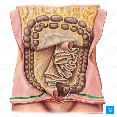 Lateral umbilical fold (Plica umbilicalis lateralis); Image: Irina Münstermann
