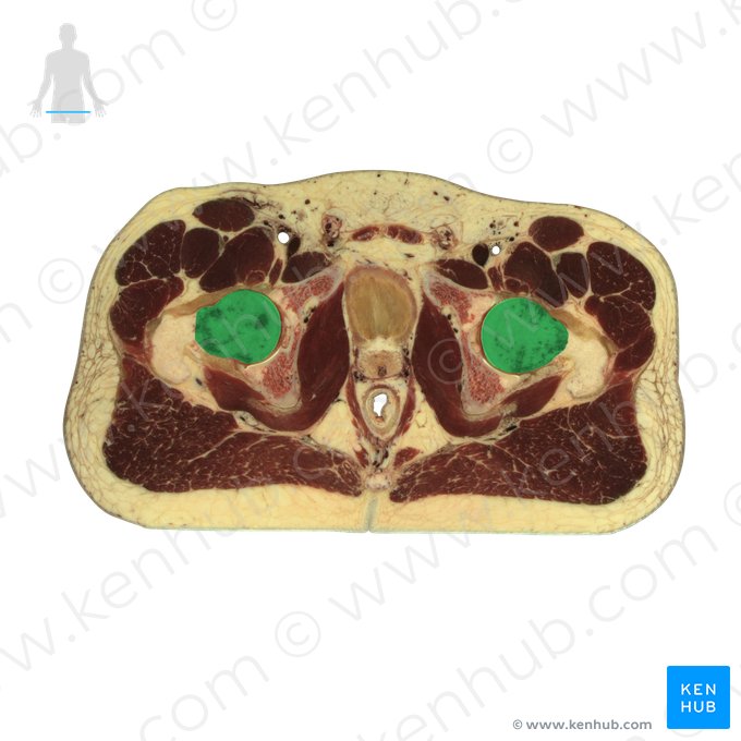 Caput ossis femoris (Kopf des Oberschenkelknochens); Bild: National Library of Medicine