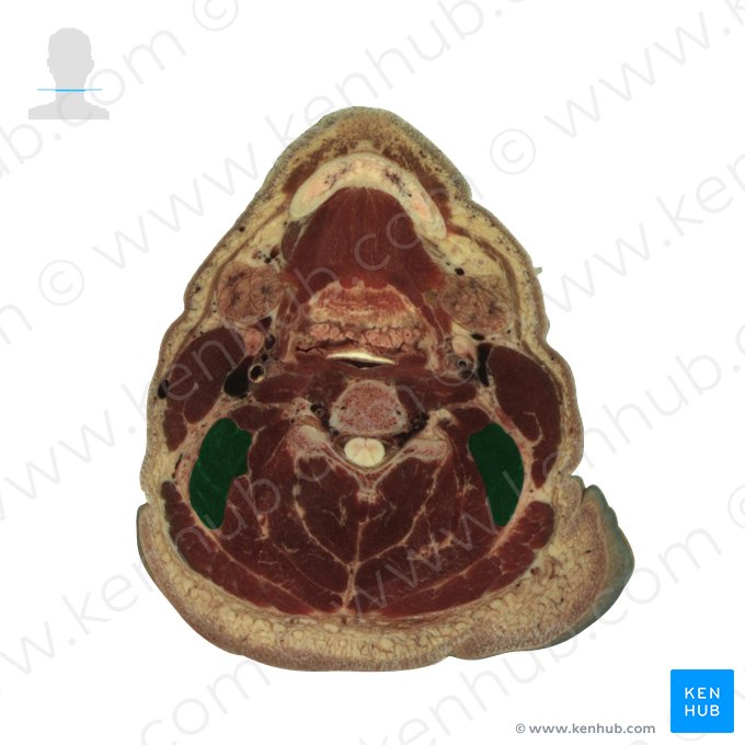 Levator scapulae muscle (Musculus levator scapulae); Image: National Library of Medicine