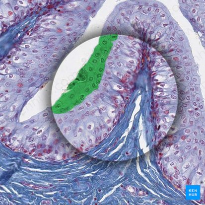Stratum superficiale urothelii (Deckzellen des Urothels); Bild: 